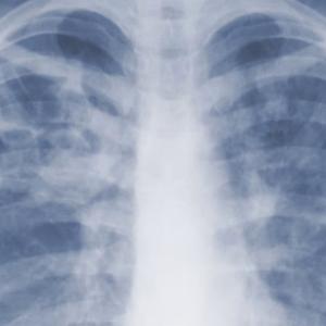 Study suggests the threat of mould-associated illnesses may be underappreciated