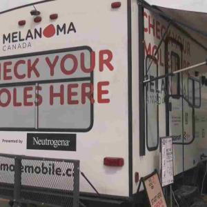 Mole Mobile brings free skin cancer screenings to Nova Scotia, New Brunswick