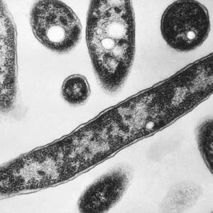New York City Legionnaires’ disease outbreak linked to 7 deaths is declared over