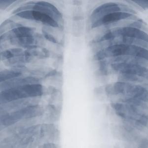 Are you underestimating mold-related illness? What U.S. study says