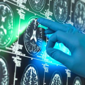 Alzheimer’s research is latest casualty in Trump administration war against ‘DEI’