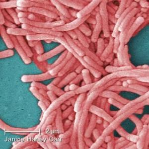 Legionnaires’ disease outbreak near downtown Toronto under investigation