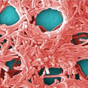 Legionnaires' disease causes and symptoms as health officials investigate Toronto outbreak