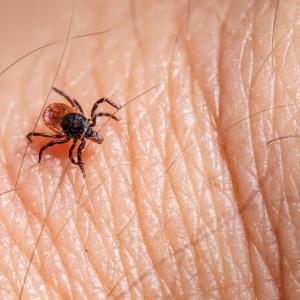 There’s a tick-borne disease on the rise that’s even worse than Lyme