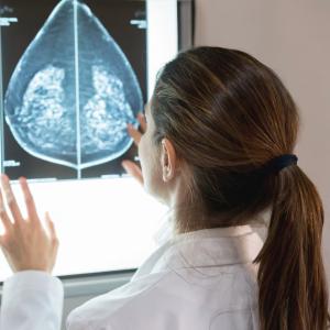 AI can detect heart disease in women using mammograms, study suggests