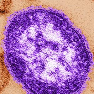 Trump’s new CDC director ordered delay in counting 2 measles-related deaths