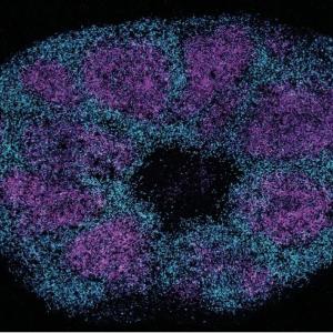 Scientists map key protein interactions linked with profound autism