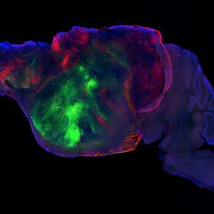 Mice with human brain cells offer a tool to study disease. Ethicists ask: What's next?
