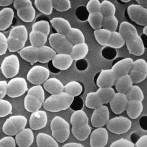 Eating sugar while taking antibiotics might harm gut bacteria