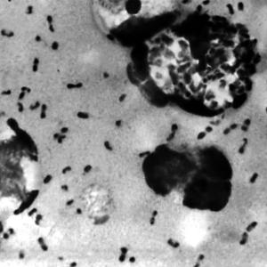 What is pneumonic plague and how dangerous is it?