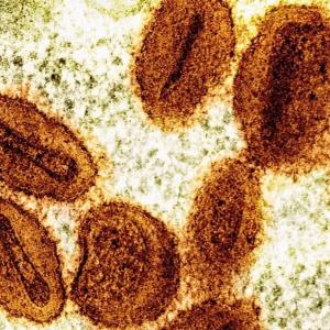 2 scientists charged with bringing deactivated mpox virus into U.S., lying to authorities