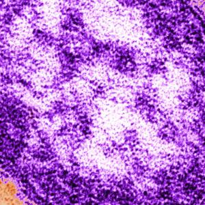 Ottawa Public Health alerting residents of possible measles exposure locations