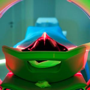 Cancer rates rising more quickly among younger people, international research finds