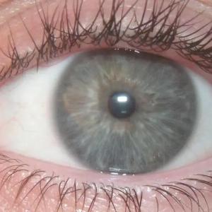 How governments can preserve trust while expanding access to vision care
