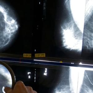 Breast cancer conference slammed for photo showing all-male panel