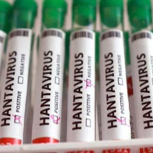 A third person in Ontario is now in isolation due to hantavirus exposure. Here's everything we know.