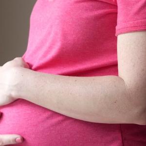 'A very unique observation': Study links endometriosis to slightly higher birth-defect risk
