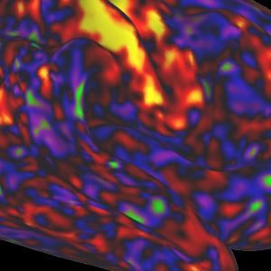 ADHD drugs may boost arousal more than attention