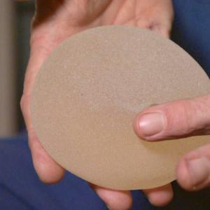 Advocates slam Health Canada's new voluntary breast implant registry