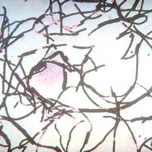 Anthrax outbreak kills more than 50 animals, infects 12 people in Zambia