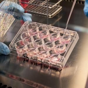 B.C. research 'opens the door' to more effective cancer therapies