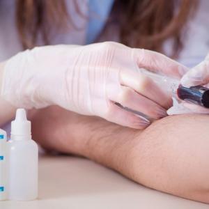Blood tests for Alzheimer's are here – but Canada isn't ready