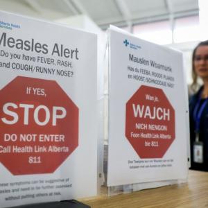 Calgary medical clinic site of potential measles exposure, province says - Calgary