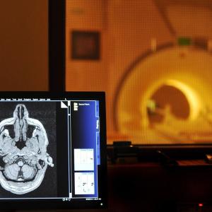 Cancer-diagnosed Albertans may have to partly pay for diagnostic scans, even after government compensation