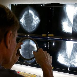 Cancer incidence and mortality rates decline across Canada, but some cancer types are increasing