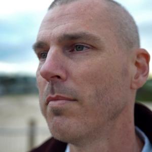 Cancer rates in Australians under 50 are rising at a pace that's alarming doctors and scientists