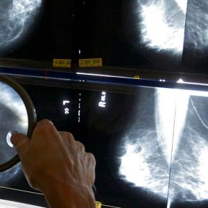 Community supports look to fill gaps in culturally informed breast cancer care for Black women