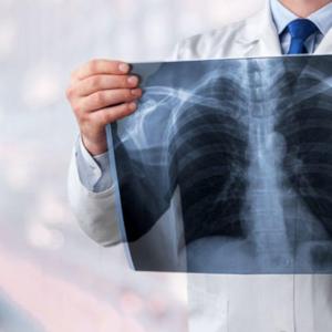 Deaths in Canada due to pneumonia rose by 20% in 2024
