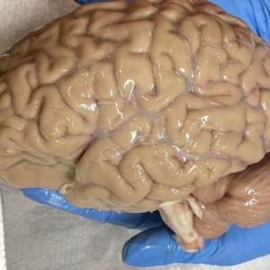 Doctors say there is a 25% chance a frozen brain or body could be revived in the future: survey