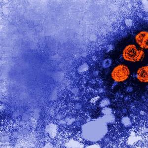 Experimental hepatitis B drug may offer 'functional cure' for some patients