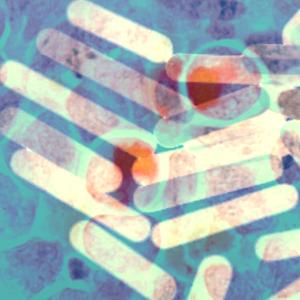 Fighting cancer with ... gold?!?!