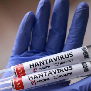 Hantavirus has no cure. Here's where researchers are at with treatments and vaccines