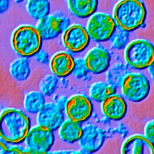 Is hantavirus the next COVID? Is the U.S. response on point? An outbreak update