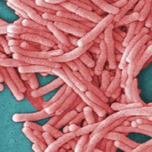 ‘It loves water’: Summer heat waves could lead to legionnaire outbreaks, expert says