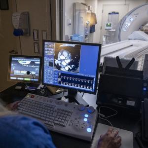 Kingston hospital first in Canada to adopt AI tool for heart disease diagnosis