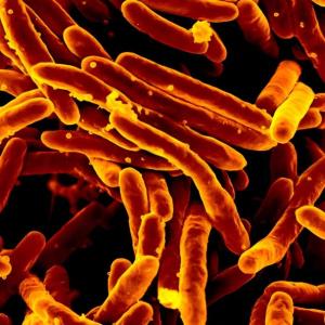 Long a dream, it's now real: a fast and accurate TB test that doesn't need phlegm