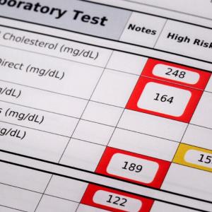 Major changes to cardiovascular guidelines suggest taking statins as young as 30