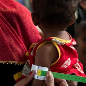 Malnutrition causes type 5 diabetes: experts
