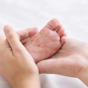Manitoba health officials confirm 9 more measles cases