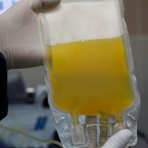 Manitoba medical examiner echoes Health Canada's probe into deaths of plasma donors