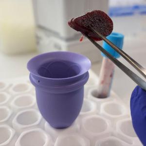 McMaster research targets menstrual cup 'mess' with absorbent tablets to tackle period stigma