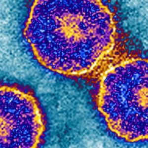 Measles isn't the only disease making a comeback. Mumps is on the rise