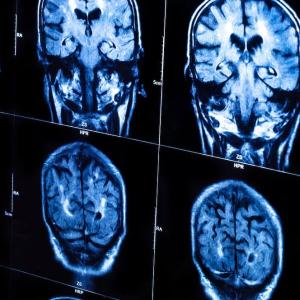 Mobile brain scans sound like science fiction. But they're now helping more Canadian patients