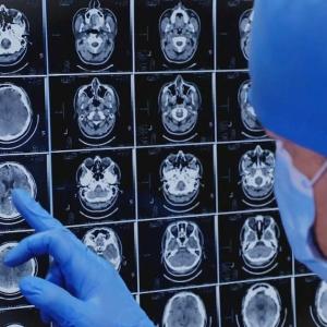 New Brunswick, feds to provide more than $4 million in Alzheimer's care training