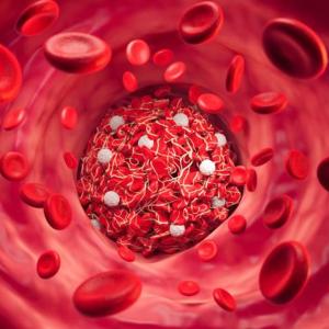 New research chips away at COVID-19 blood clot mystery