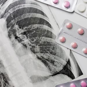 New strain of tuberculosis cases in Tennessee is resistant to treatment options